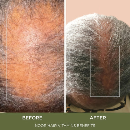 NOOR HAIR Healthy Hair Formula, Hair Growth Supplement Supporting Thick Hair and Fast Hair Regrowth. Vitamin C, B6, Zinc, Propietary Non-GMO & Gluten Free Womens Hair Loss Vitamins