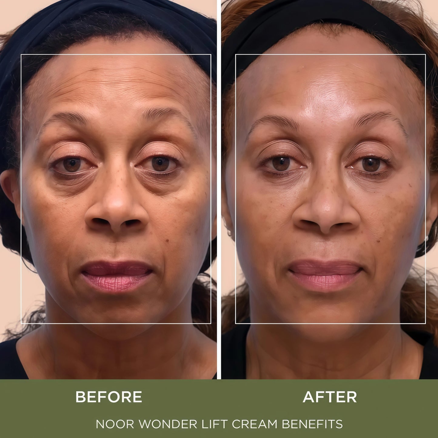 Noor Wonder Lift Cream for Women, Natural Anti-Aging Wrinkle teatment with Syn-Ake natural blend Promotes Anti Aging and Significantly Less Wrinkles In As Little As A Few Days