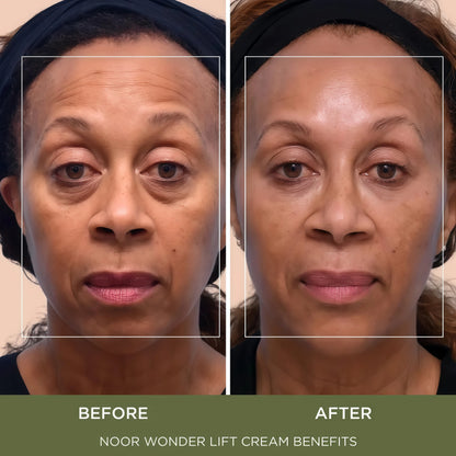 Noor Wonder Lift Cream for Women, Natural Anti-Aging Wrinkle teatment with Syn-Ake natural blend Promotes Anti Aging and Significantly Less Wrinkles In As Little As A Few Days